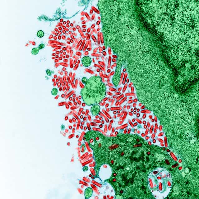 Microscopy image of many rod-shaped rabies particles infecting a hamster kidney cell