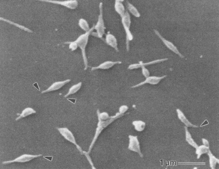 Micrographie électronique à balayage de bactéries M. pneumoniae. Les éléments utilisés pour la fixation sont indiqués par des flèches noires.