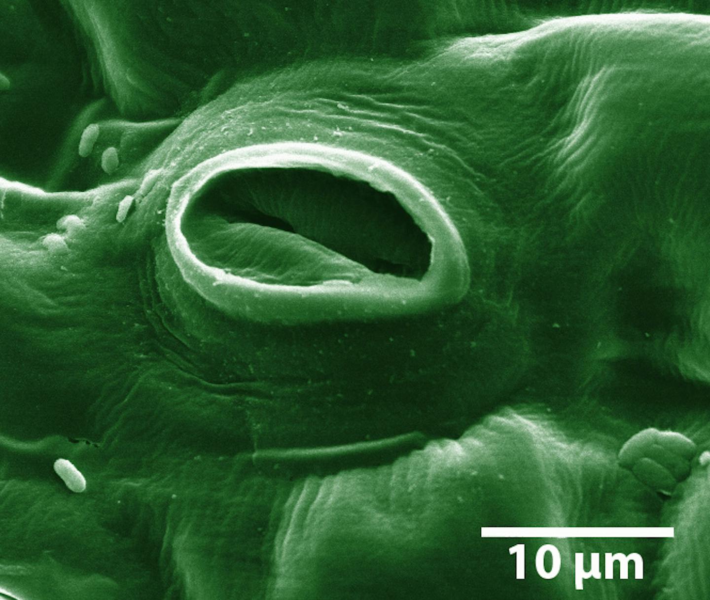 A microscopic photo showing a green mouth shape.