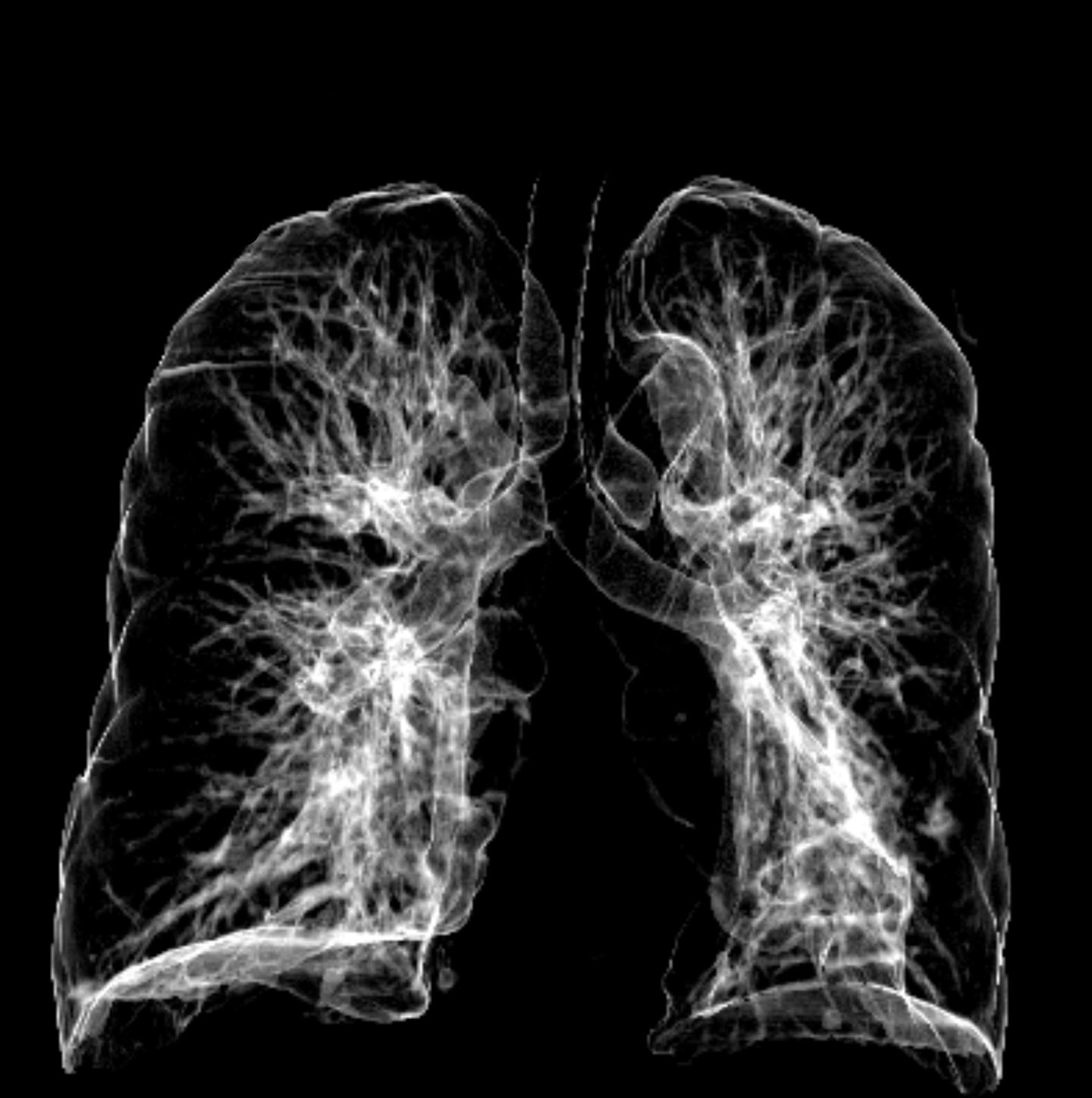 Why do people and animals need to breathe? A biologist explains why you
