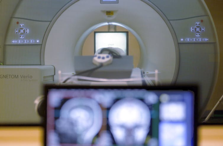 A white MRI machine, which has a tube with a cot inside and a white monitor in the background, and a black monitor with blurred images of a human skull, in the foreground.