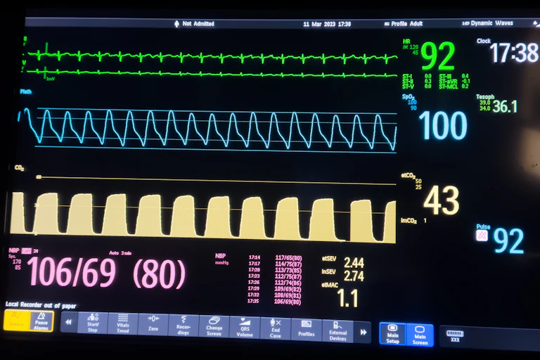 A hospital monitor showing body signals.