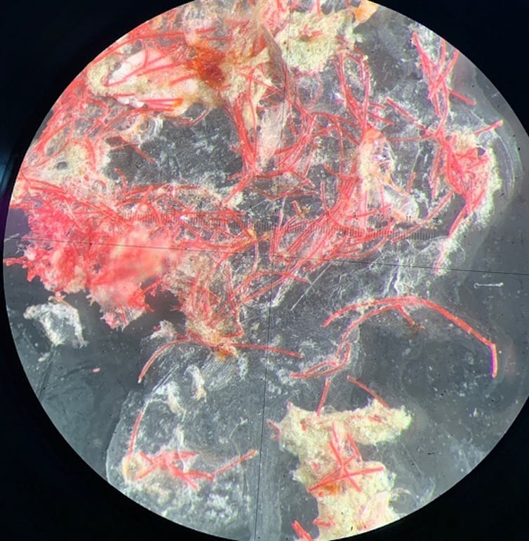 A tangle of red fibers under a microscope.