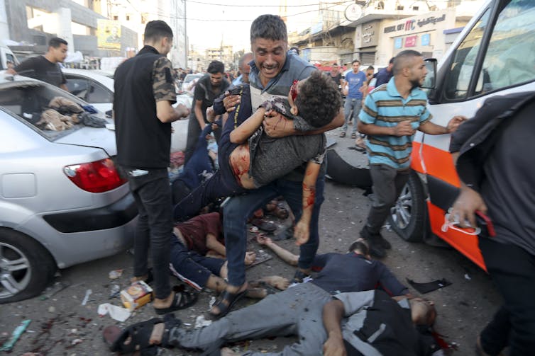 A man cries while holding an injured boy in his arms, while two bodies of the those dead lie on the ground.