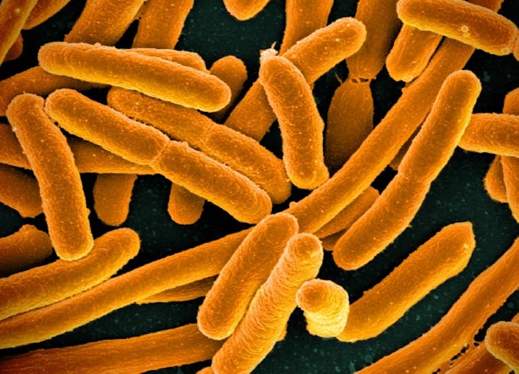 Micrographie électronique à balayage, en fausses couleurs, de bactéries Escherichia coli en culture.