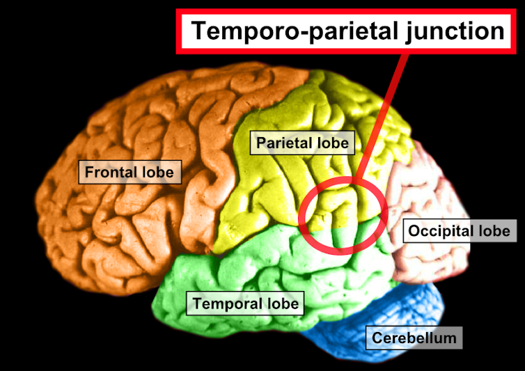 Image pinpointing the temporoparietal junction.