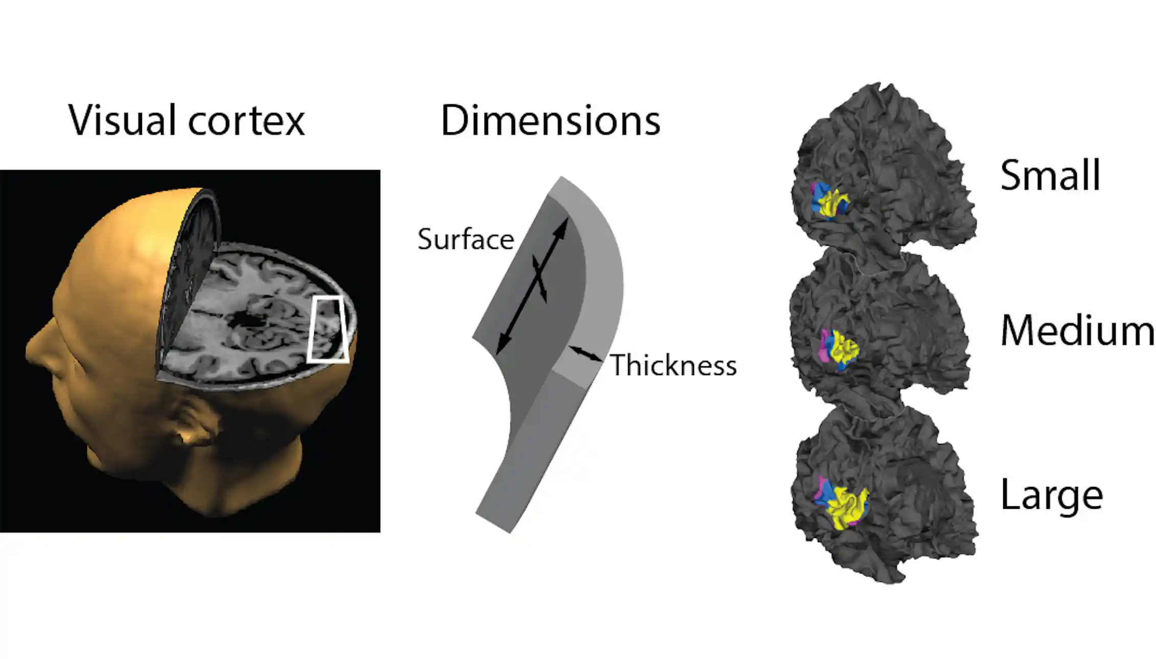 Brain size matters when it comes to remembering