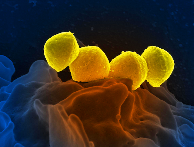 A microscopic image of group A Streptococcus