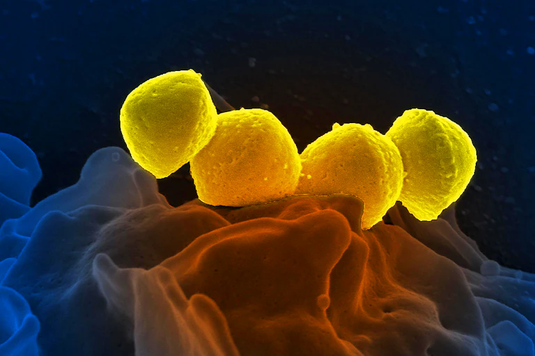 A microscopic image of group A Streptococcus