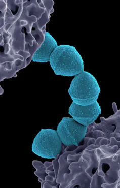 Microscopic view of group A Streptococcus bacteria