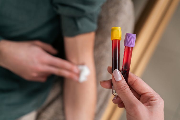 What do your blood test results mean? A toxicologist explains the basics of how to interpret them