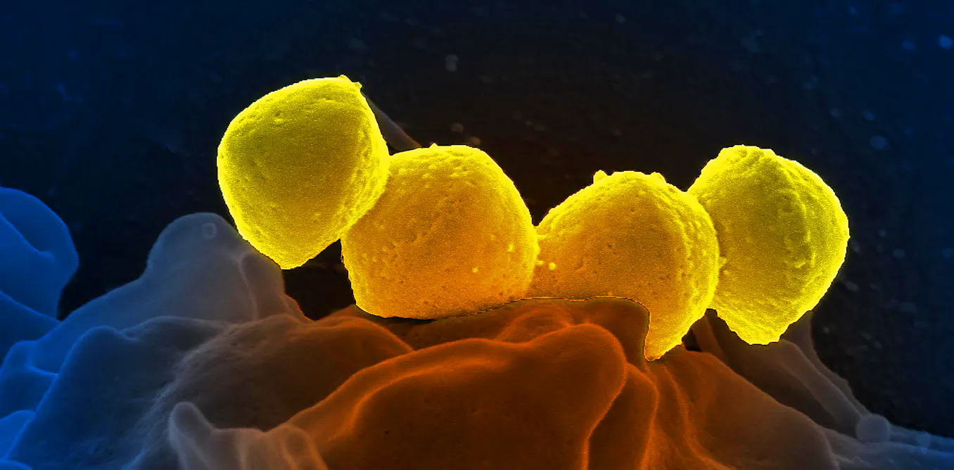 Treptocoque Hausse des cas d’infection invasive au streptocoque A : comment il se ...