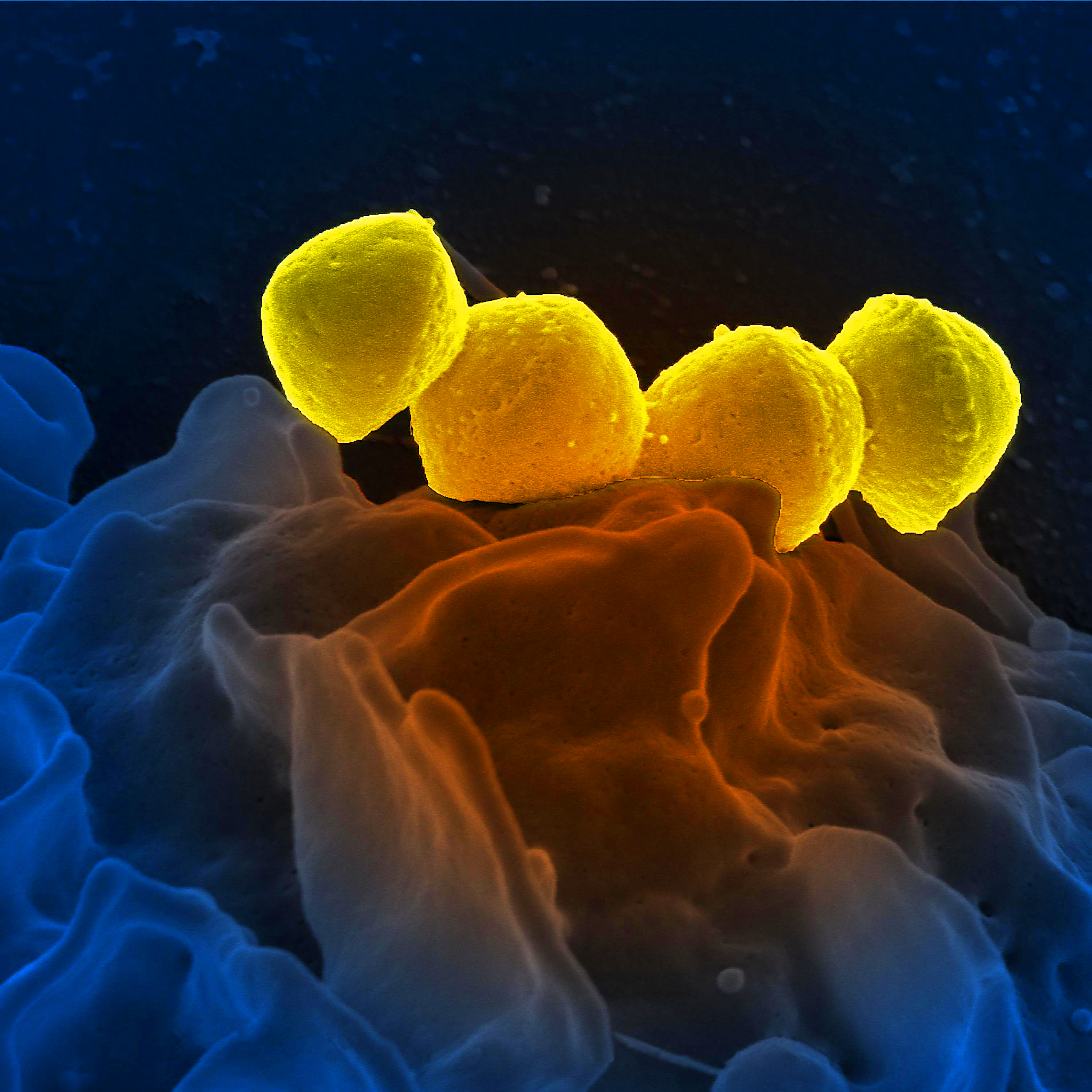Image microscopique d'un streptocoque du groupe A