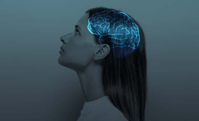 Graphic of a woman with the x-ray of her brain showing