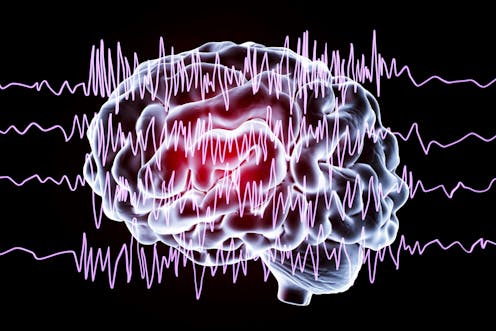 A century after the EEG was discovered, it remains a crucial tool for understanding the brain