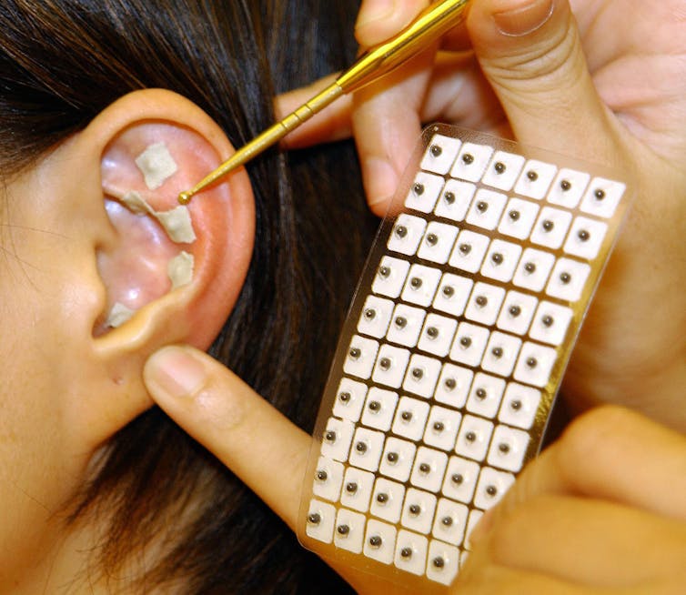 Close up of a pair of hands and one ear. One hand holds a pack of ear seeds and the other applies an ear seed to the upper ear using a gold applicator stick