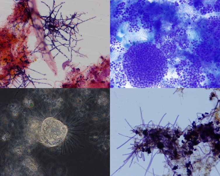 Compound microscope images of microbes in waste sludge