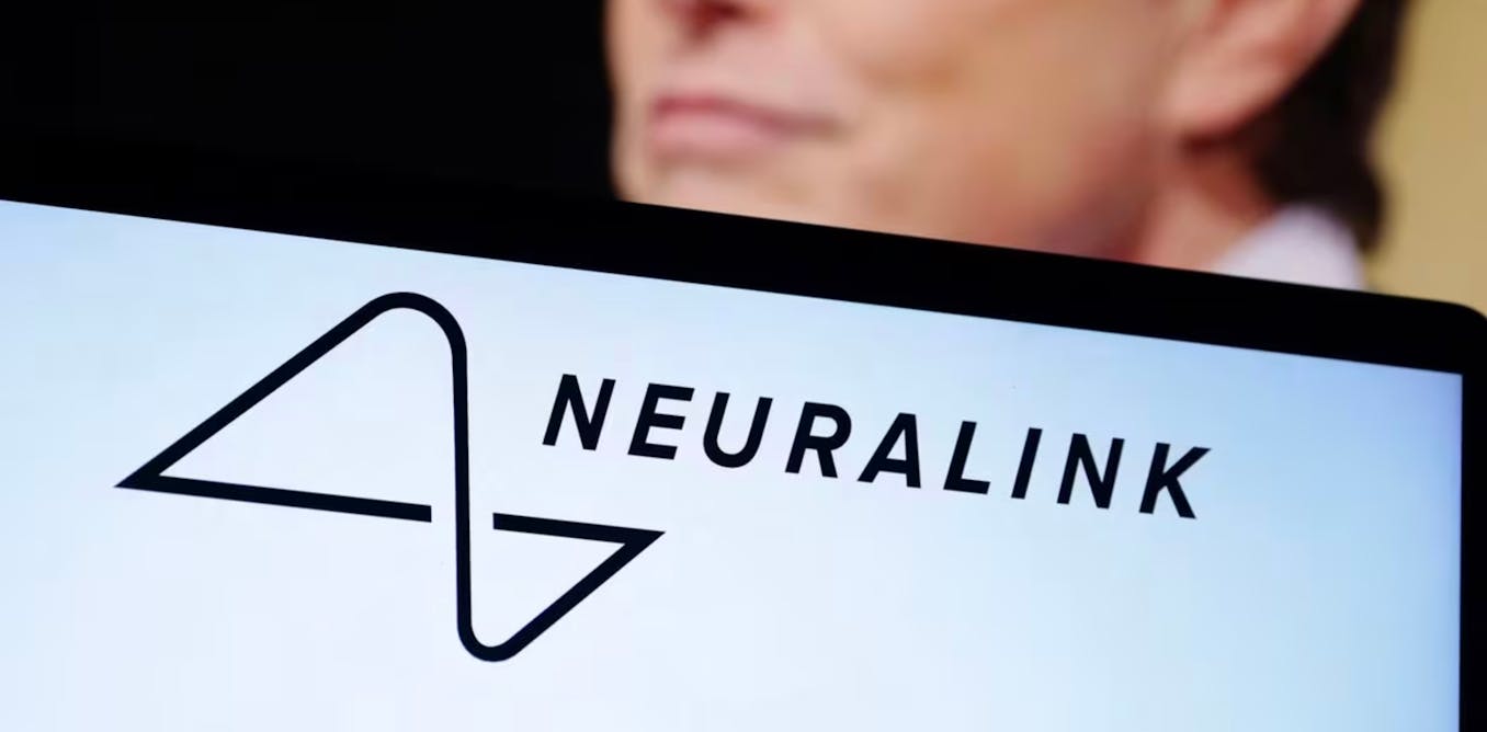 The first Neuralink brain implant signals a new phase for human-computer interaction