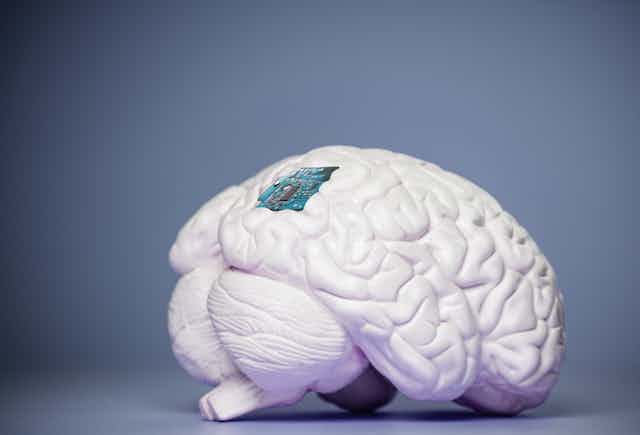 Ilustração de um cérebro com um chip na superfície