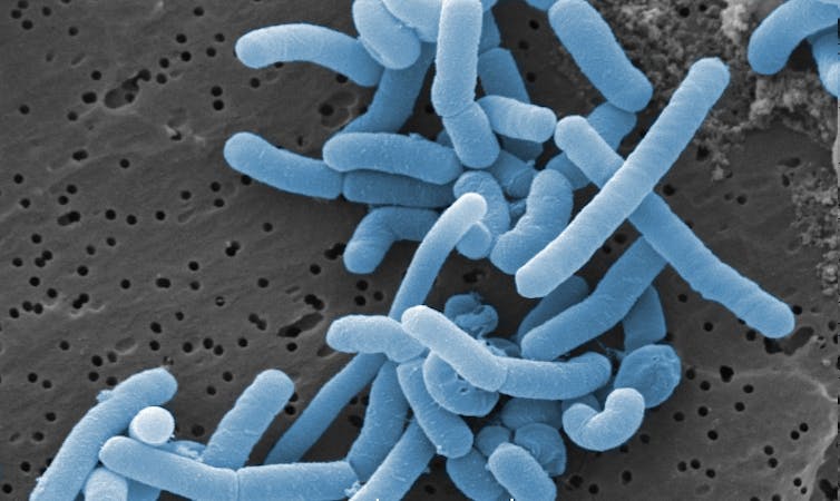 Microscopy image of rod-shaped Lactobacillus stained blue