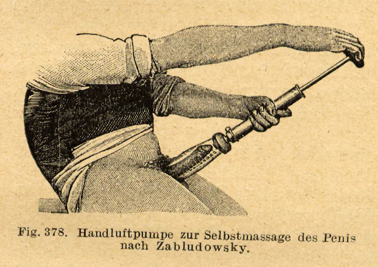 An old advert for a penis pump.