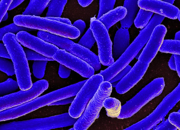 Bacteria can develop resistance to drugs they haven’t encountered before − scientists figured this out decades ago in a classic experiment