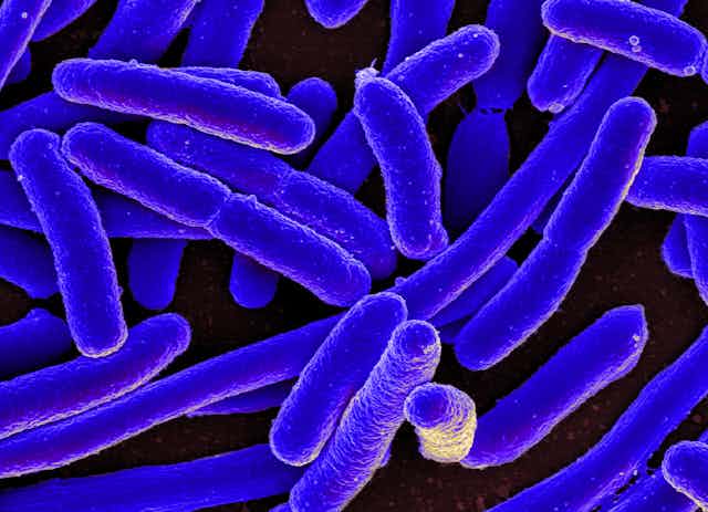 Microscopy image of rod-shaped E. coli, stained purple