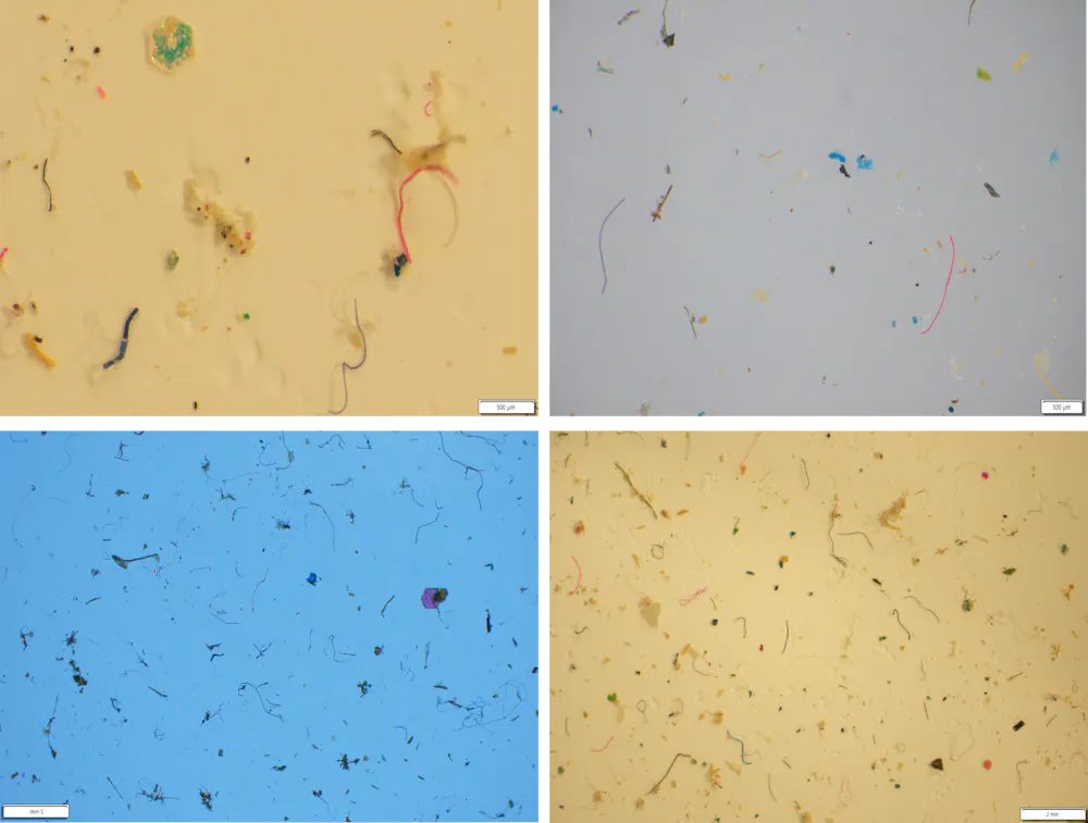 Australians are washing microplastics down the drain and it’s ending up ...