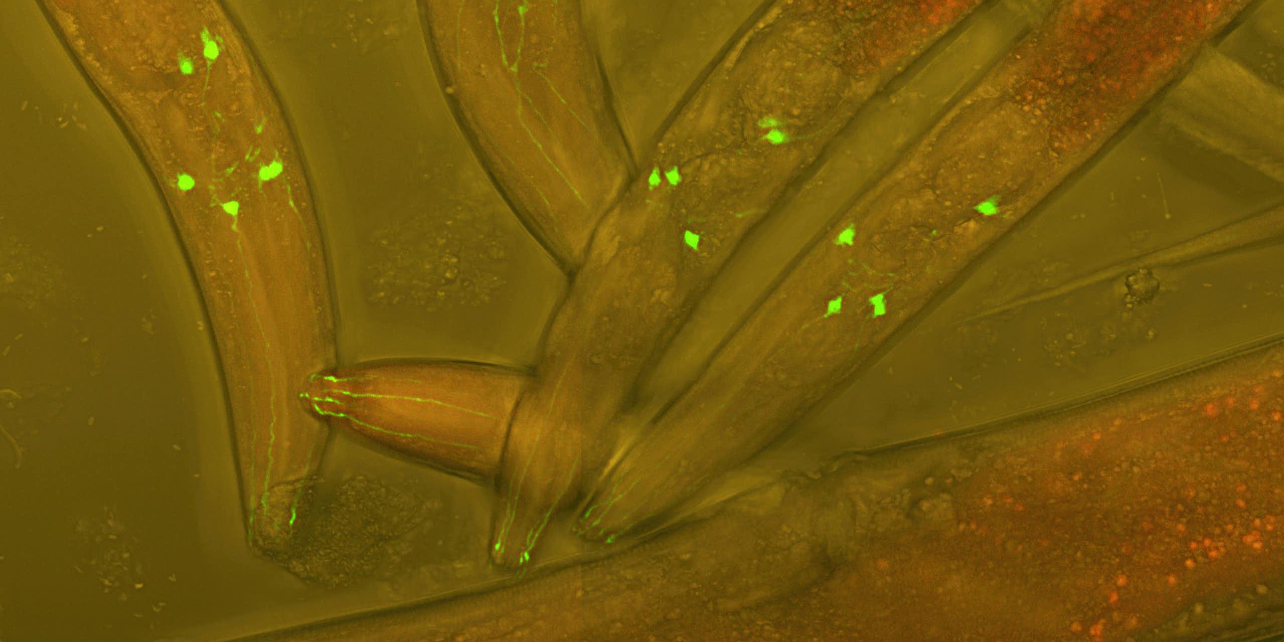 Vers Caenorhabditis elegans vivants, dont les neurones sont rendus fluorescents afin de visualiser le développement neuronal dans un ver vivant.