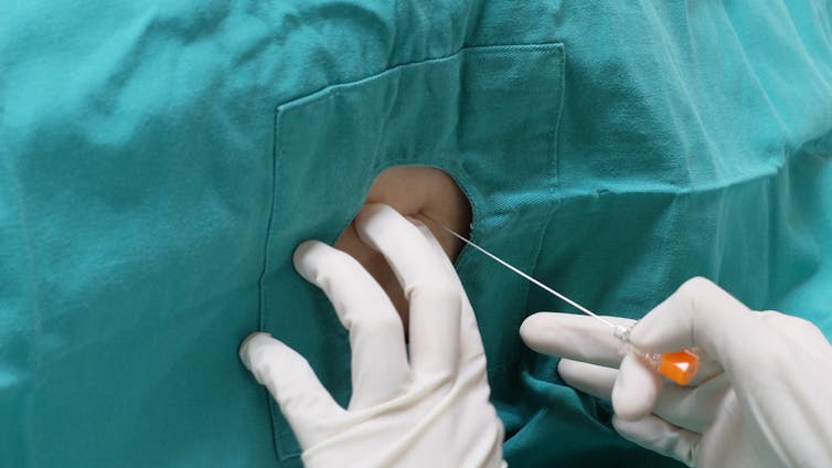 A lumbar puncture being performed