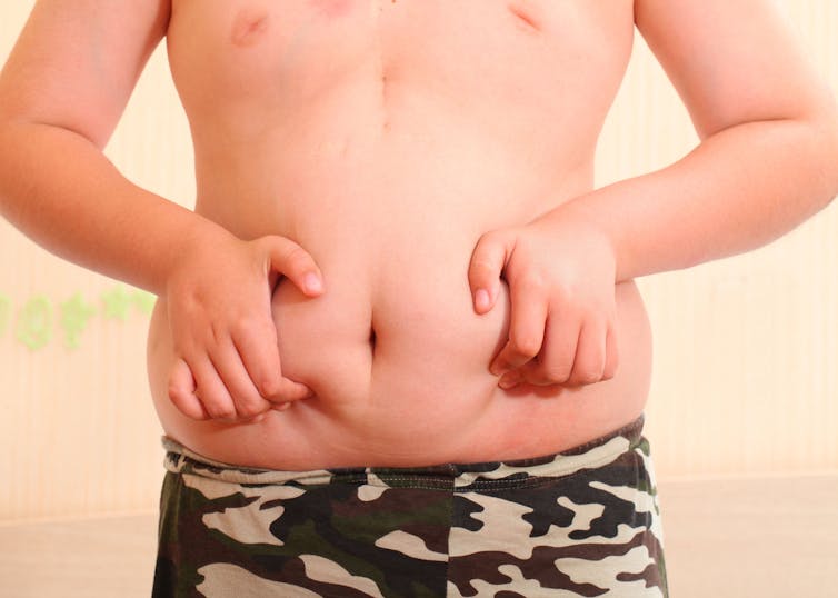 Obesity Is Now So Normal That Many Parents Can't See If Their Child Is Too  Fat