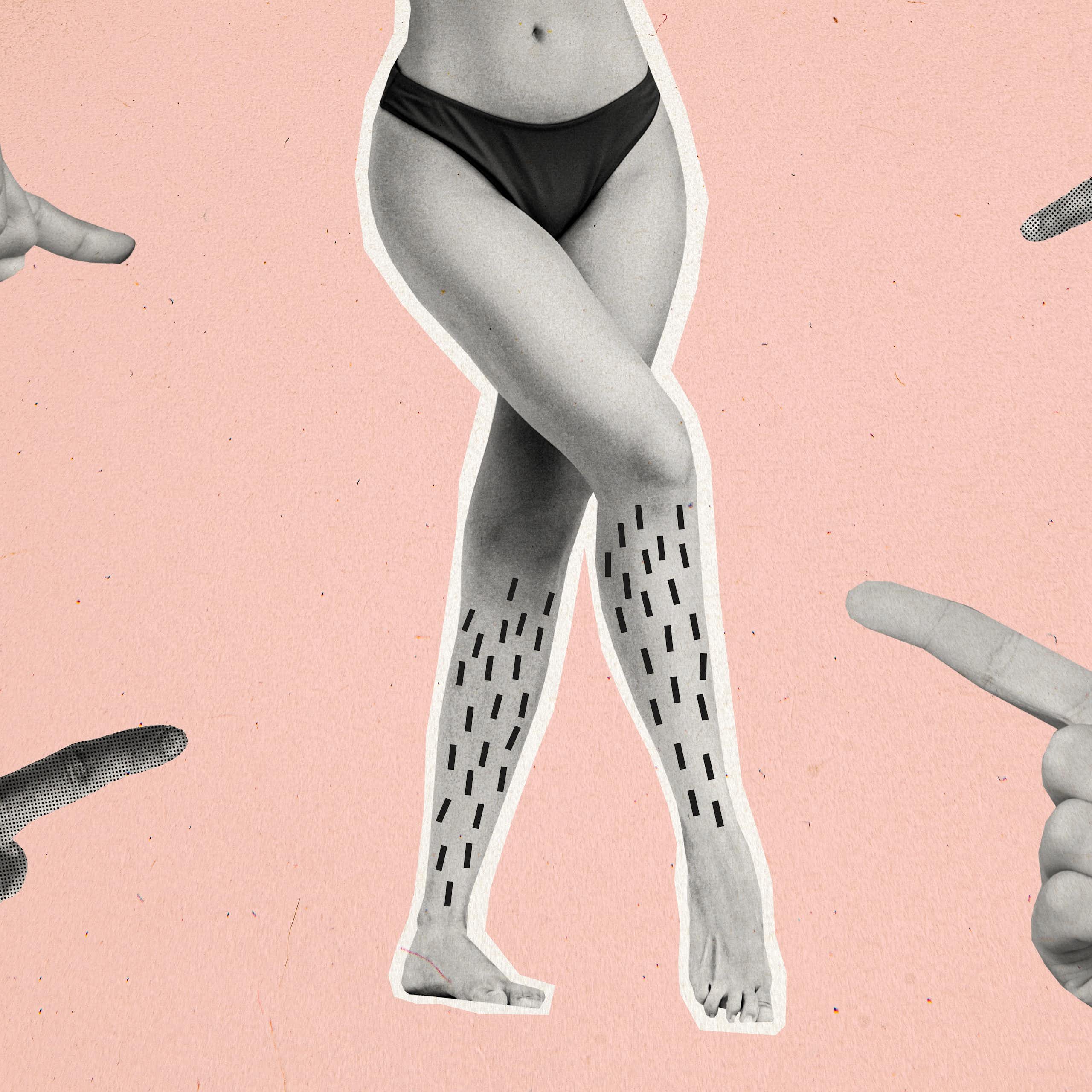 Mulus tanpa bulu: ekspektasi tak masuk akal pada tubuh perempuan