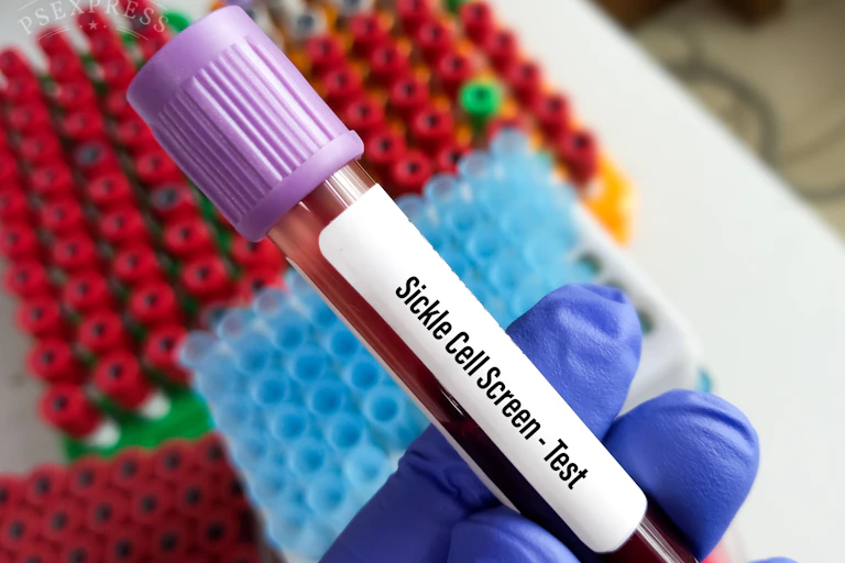 Medical tube for blood test.