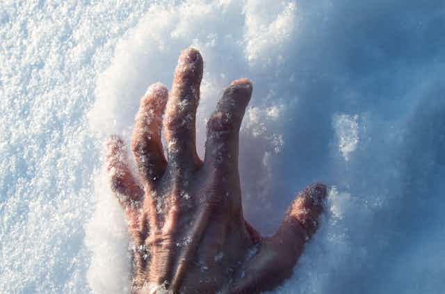 A frozen hand on snow