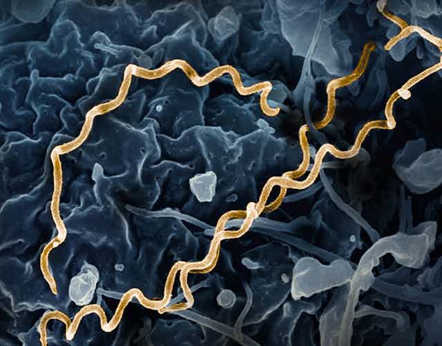 Microscopic view of Treponema pallidum bacteria