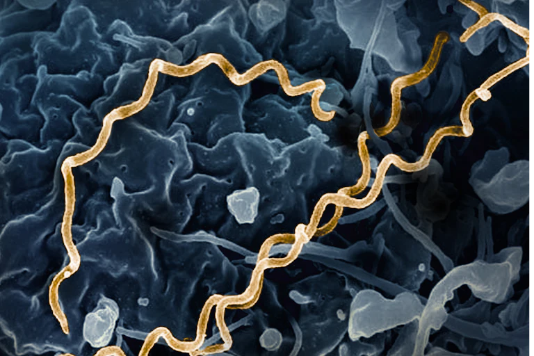 Microscopic view of Treponema pallidum bacteria