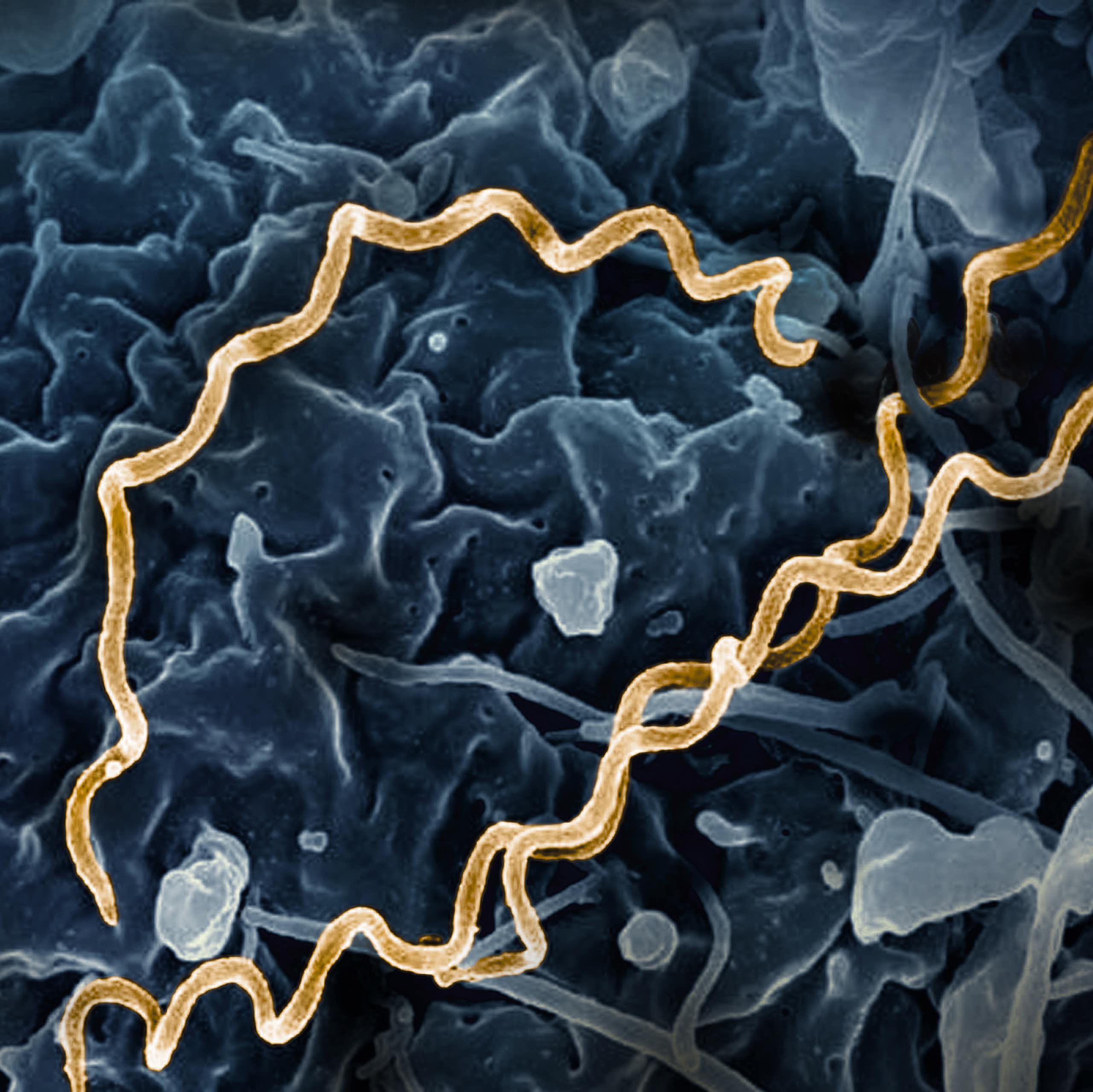 Microscopic view of Treponema pallidum bacteria
