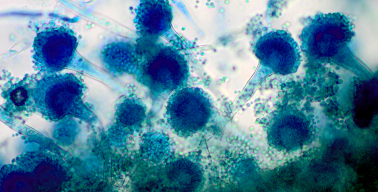 Une préparation du champignon microscopique Aspergillus fumigatus, vu sous un objectif grossissant 40 fois