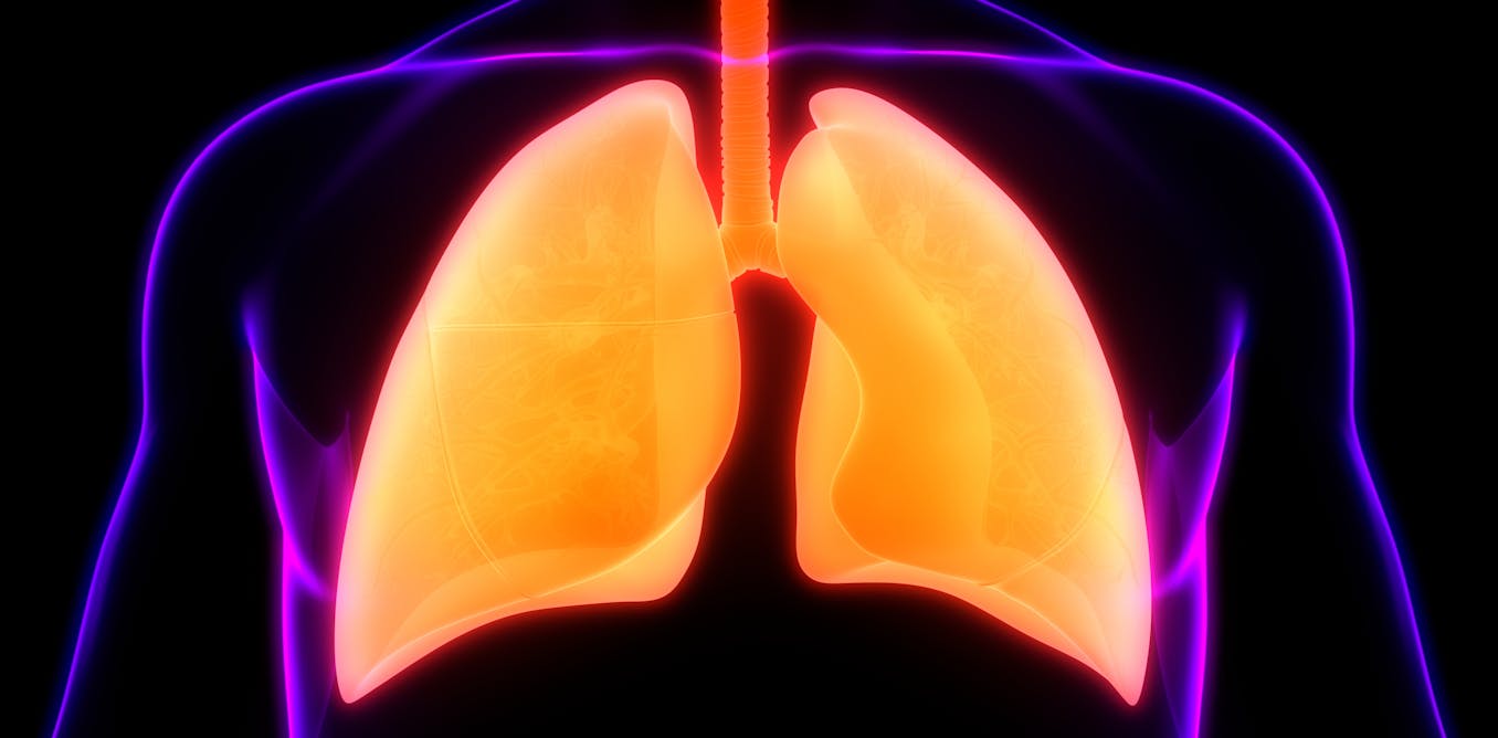 Omega-3 fatty acids are linked to better lung health, particularly in patients with pulmonary fibrosis