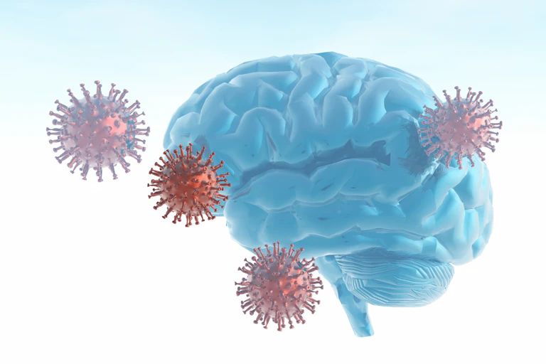 Conceptual illustration of brain fog with a brain surrounded by four SARS-CoV-2 viral particles.