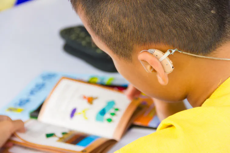 A child seen with a hearing device.