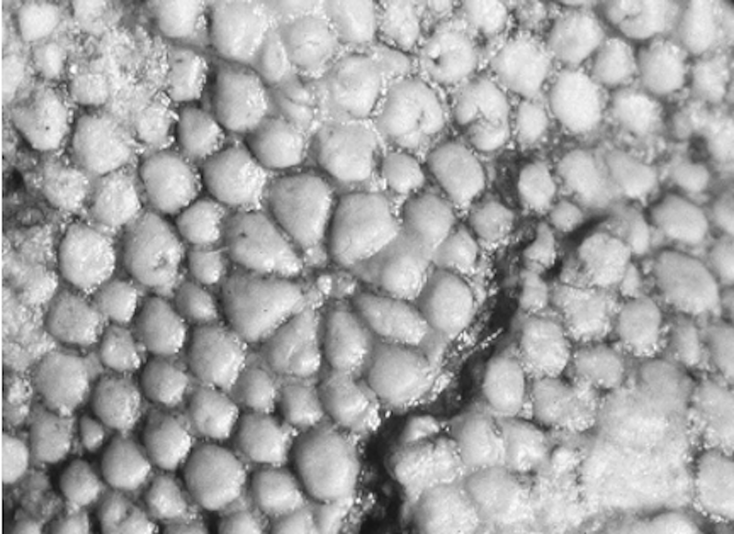 Black and white microscopic image showing a bumpy pattern.