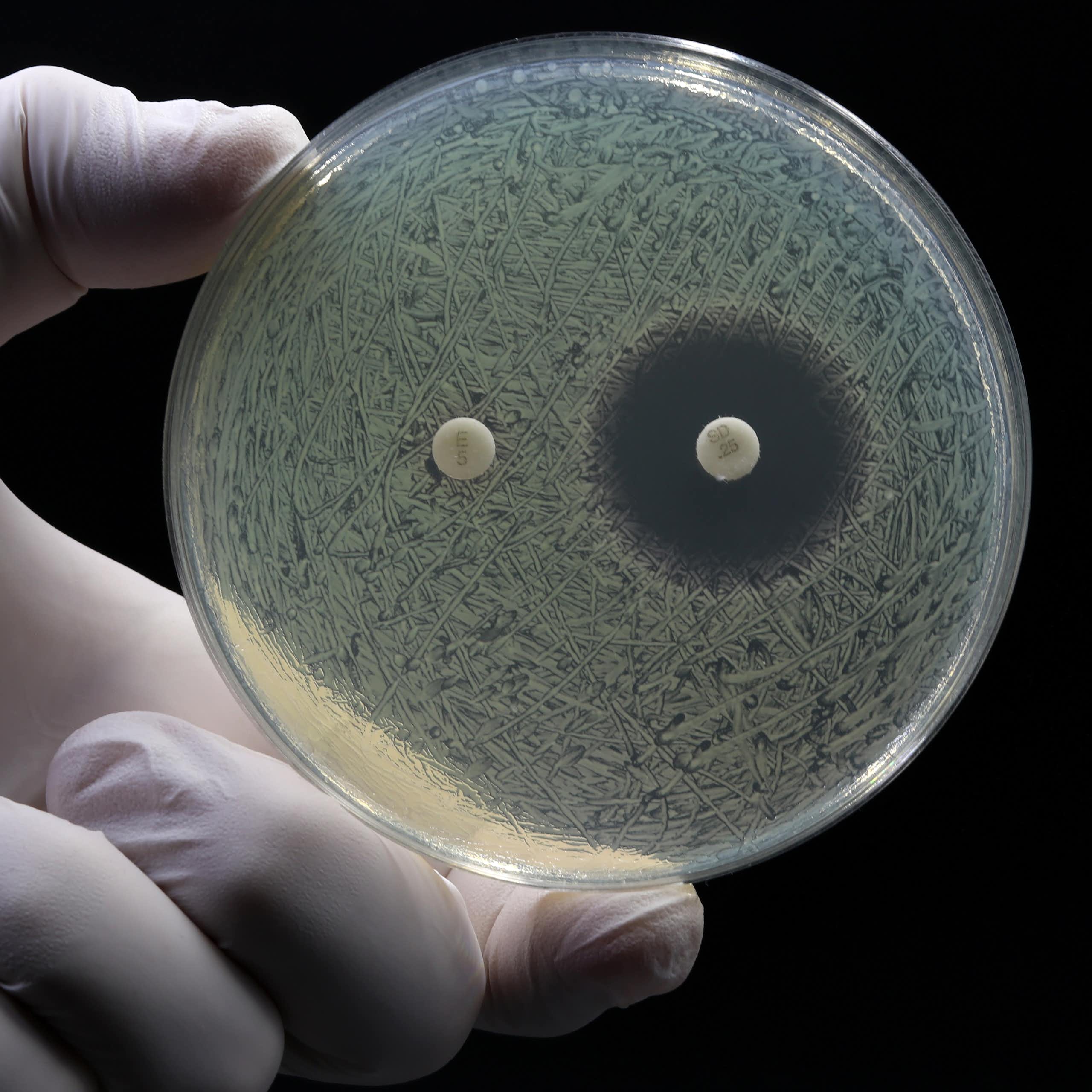 il est possible de voir l'effet d'un antibiotique dans une boite de Petri.