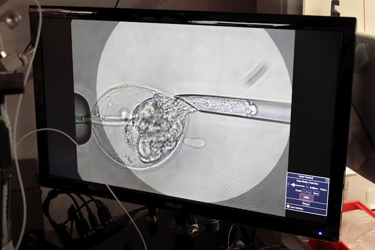 A screen shows a microscope's view of a needle and cells.