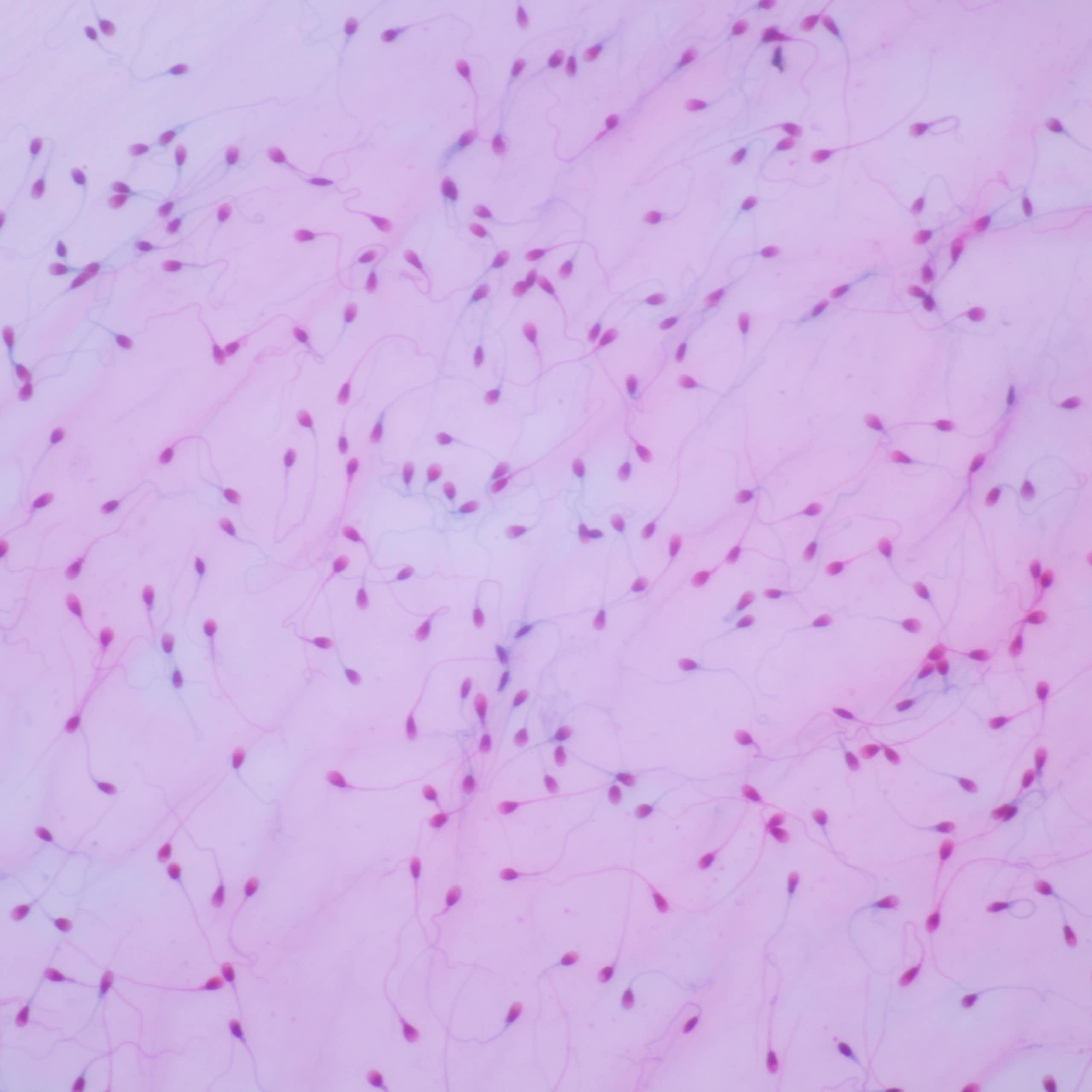 La microbiota también podría desempeñar un papel en la fertilidad del hombre