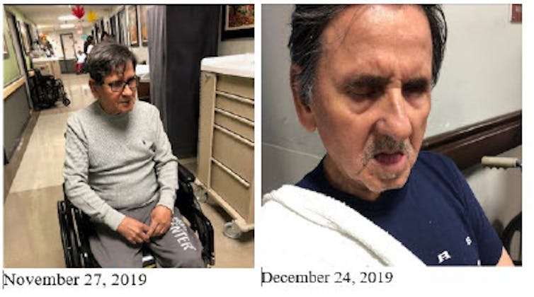 Side-by-side pictures of a man in a wheelchair with glasses in November, 2019 and the same man looking less alert, unshaven and with an eye wound in December, 2019
