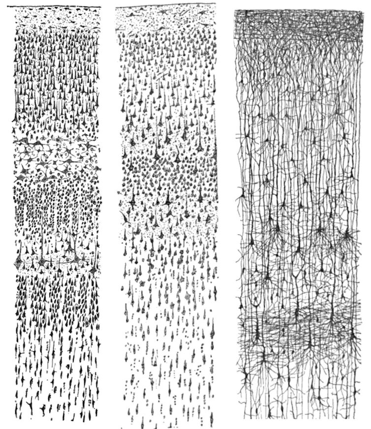 Illustration représentant des cellules nerveuses et leurs connexions qui ressemblent à trois cablages verticaux composés d'une multitude de fils.