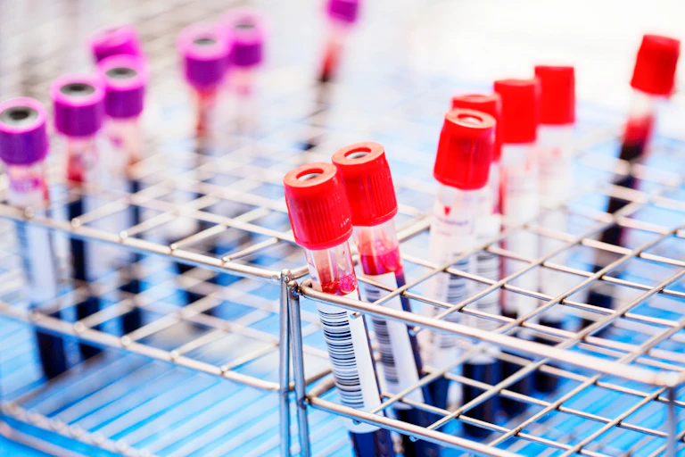 vials of blood in a wire rack