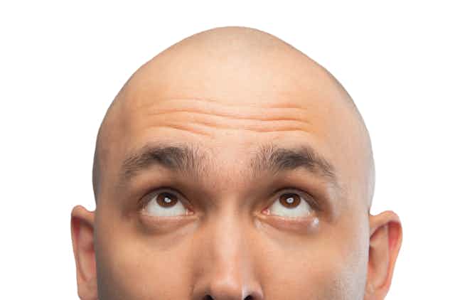 Close up photo of a bald man with light skin looking up towards his head