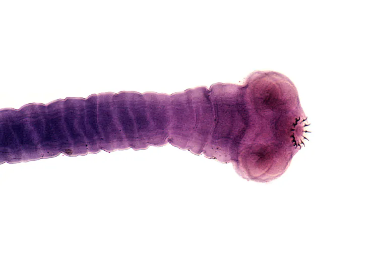 The head of a pork tapeworm.